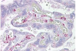 Anti-ING3 antibody IHC staining of human placenta. (ING3 antibody  (AA 36-85))