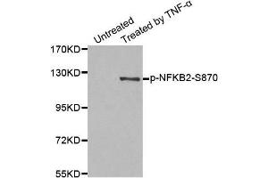 Western blot analysis of extract from MDA-MB-435 cells, using Phospho-NFKB2-S870 antibody.