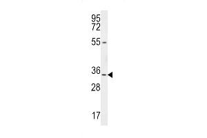 LRRC18 antibody  (C-Term)