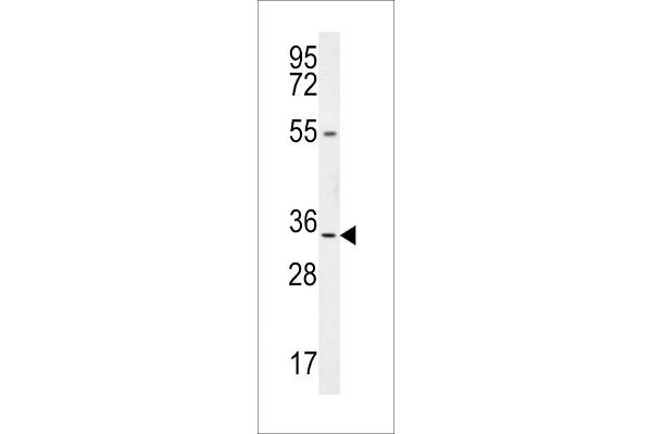 LRRC18 antibody  (C-Term)