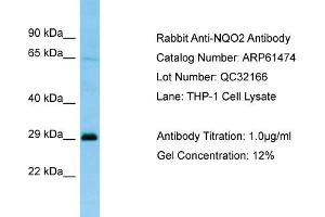 Western Blotting (WB) image for anti-NQO2 (NQO2) (C-Term) antibody (ABIN2788817)