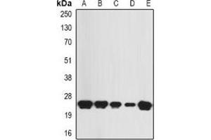 Western blot analysis of KNP-I expression in SW480 (A), HepG2 (B), mouse skin (C), mouse heart (D), rat skeletal muscle (E) whole cell lysates. (KNP-1 antibody)