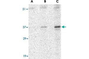 Western blot analysis of UNG in C2C12 cell lysate with UNG polyclonal antibody  at (A) 0. (UNG antibody  (N-Term))