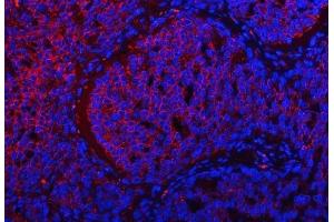 IF analysis of TRMT2B using anti-TRMT2B antibody (ABIN7599456). (TRMT2B antibody  (AA 1-504))
