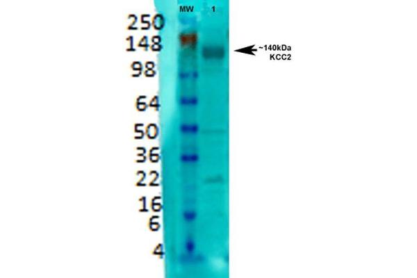 KCC2 抗体  (AA 932-1043) (HRP)