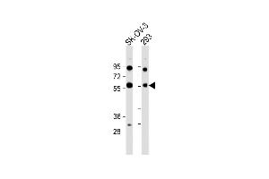 All lanes : Anti-X8 Antibody (Center) at 1:1000 dilution Lane 1: SK-OV-3 whole cell lysate Lane 2: 293 whole cell lysate Lysates/proteins at 20 μg per lane. (PAX8 antibody  (AA 285-313))