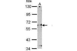 WB Image Sample (30 ug of whole cell lysate) A: NIH-3T3 7. (Proteasome 26S S3 (Center) antibody)