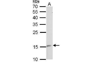 WB Image LMO1 antibody detects LMO1 protein by Western blot analysis.