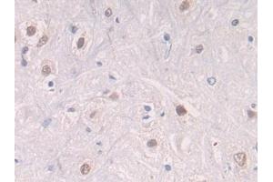 Detection of CTSG in Rat Spinal cord Tissue using Polyclonal Antibody to Cathepsin G (CTSG) (Cathepsin G antibody  (AA 51-250))