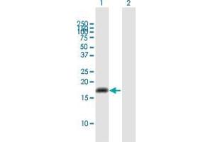 Western Blot analysis of CYP2U1 expression in transfected 293T cell line by CYP2U1 MaxPab polyclonal antibody.