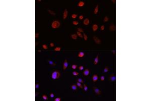 Immunohistochemistry of paraffin-embedded rat lung using  Rabbit pAb (ABIN6133551, ABIN6136733, ABIN6136738 and ABIN6215039) at dilution of 1:150 (40x lens). (AKT1 antibody  (C-Term))
