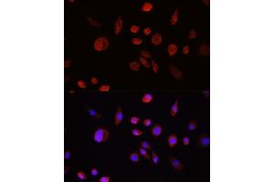 Immunohistochemistry of paraffin-embedded rat lung using  Rabbit pAb (ABIN6133551, ABIN6136733, ABIN6136738 and ABIN6215039) at dilution of 1:150 (40x lens). (AKT1 antibody  (C-Term))