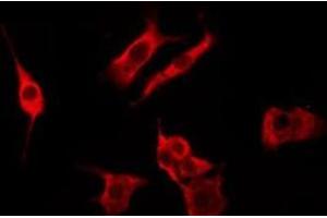 ABIN6276263 staining Hela by IF/ICC. (OR51A4 antibody  (Internal Region))