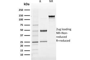 SDS-PAGE (SDS) image for anti-Aldo-Keto Reductase Family 1, Member B1 (Aldose Reductase) (AKR1B1) antibody (ABIN6939403)