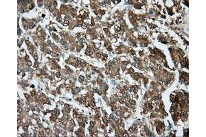 Immunohistochemical staining of paraffin-embedded pancreas tissue using anti-PIM2 mouse monoclonal antibody. (TPMT antibody)