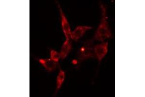 ABIN6274589 staining Hela cells by IF/ICC. (ARRDC3 antibody  (C-Term))