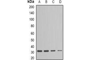 Western blot analysis of ESD expression in Jurkat (A), HepG2 (B), mouse liver (C), mouse kidney (D) whole cell lysates. (Esterase D antibody)
