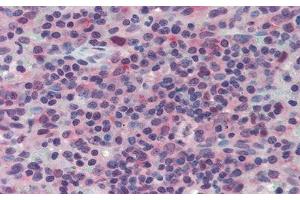 Detection of LAG3 in Human Spleen Tissue using Polyclonal Antibody to Lymphocyte Activation Gene 3 (LAG3) (LAG3 antibody  (AA 209-451))