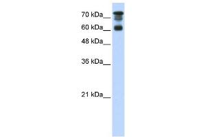 WB Suggested Anti-PPP1R13L Antibody Titration:  0.