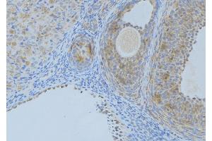 ABIN6276407 at 1/100 staining Human uterus tissue by IHC-P. (Angiopoietin 2 antibody  (N-Term))