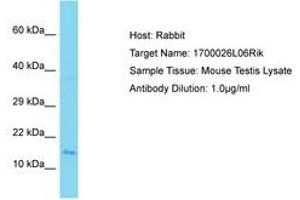 Image no. 1 for anti-Chromosome 9 Open Reading Frame 9 (C9ORF9) (AA 92-141) antibody (ABIN6750340) (C9orf9 antibody  (AA 92-141))
