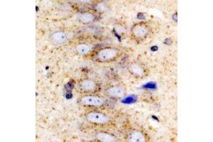 Immunohistochemistry (IHC) image for anti-serpin Peptidase Inhibitor, Clade A (Alpha-1 Antiproteinase, Antitrypsin), Member 10 (SERPINA10) antibody (ABIN7308316) (SERPINA10 antibody)
