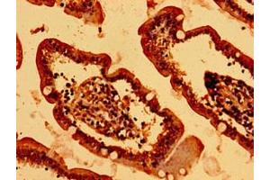 HIST1H2BK antibody  (AA 2-126)