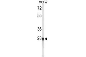 Western blot analysis of ABHDB Antibody (Center) in MCF-7 cell line lysates (35 µg/lane). (ABHD11 antibody  (Middle Region))