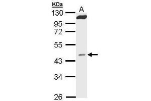 WB Image Sample (30 ug of whole cell lysate) A: Hep G2 , 10% SDS PAGE antibody diluted at 1:1000 (MVD antibody  (Center))