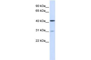 WB Suggested Anti-TMPRSS11D Antibody Titration:  1 ug/ml  Positive Control:  293T cells lysate