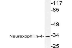 Western blot (WB) analysis of Neurexophilin-4 antibody in extracts from HUVEC cells. (Neurexophilin 4 antibody)