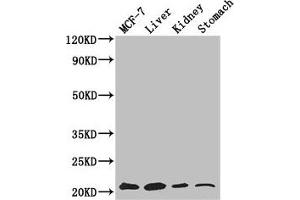 Western Blot Positive WB detected in: MCF-7 whole cell lysate, Mouse liver tissue, Mouse kidney tissue, Mouse stomach tissue All lanes: GNPNAT1 antibody at 3. (GNPNAT1 antibody  (AA 1-184))