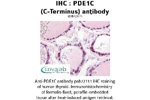 Image no. 1 for anti-phosphodiesterase 1C, Calmodulin-Dependent 70kDa (PDE1C) (C-Term) antibody (ABIN1737910)