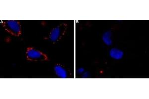 Expression of NaV1. (SCN3A antibody  (3rd Extracellular Loop, Domain 1))