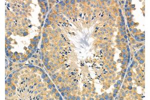 ABIN6264077 and ABIN6278944 at 1/100 staining Mouse testis tissue by IHC-P.