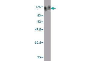 Western Blot detection against Immunogen (120. (TOP3B antibody  (AA 1-862))