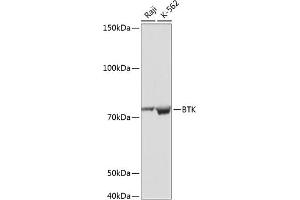 BTK antibody