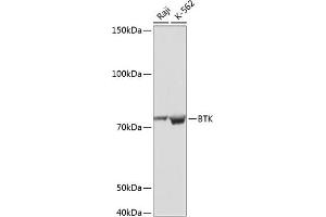Western blot analysis of extracts of various cell lines, using BTK antibody (ABIN7265950) at 1:1000 dilution. (BTK antibody)