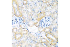 Immunohistochemistry of paraffin-embedded mouse kidney using CEACAM7 antibody at dilution of 1:100 (40x lens). (CEACAM7 antibody)