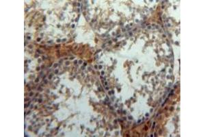 #VALUE! (PPT1 antibody  (AA 28-279))