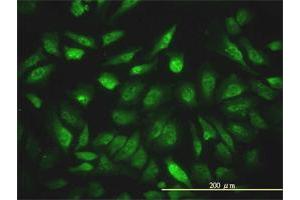 Immunofluorescence of monoclonal antibody to NCOA4 on HeLa cell. (NCOA4 antibody  (AA 1-575))