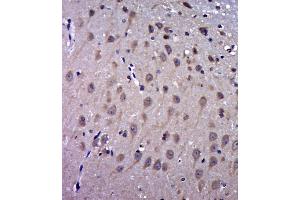 Paraformaldehyde-fixed, paraffin embedded rat brain, Antigen retrieval by boiling in sodium citrate buffer (pH6. (FAM3C antibody  (AA 151-227))
