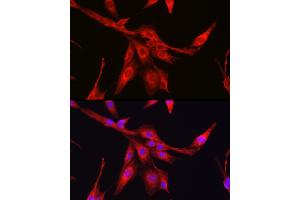 Immunofluorescence (IF) image for anti-Glutathione Synthetase (GSS) (AA 373-474) antibody (ABIN7267451)