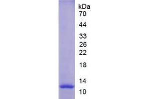 SDS-PAGE analysis of Rat MMP12 Protein. (MMP12 Protein)