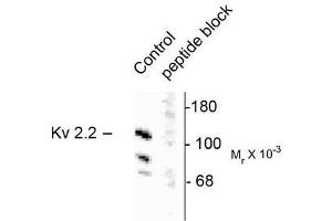 Image no. 1 for anti-Potassium Voltage-Gated Channel, Shab-Related Subfamily, Member 2 (KCNB2) antibody (ABIN372705) (Kv2.2 antibody)