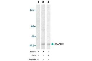 Western blot analysis of extracts from 293 using MAP2K1 polyclonal antibody . (MEK1 antibody)