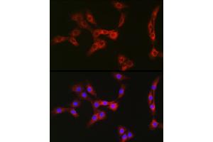Immunofluorescence (IF) image for anti-Spectrin Repeat Containing, Nuclear Envelope 1 (SYNE1) antibody (ABIN7270520)