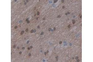 IHC-P analysis of Human Tissue, with DAB staining. (ZFHX4 antibody  (AA 1-189))