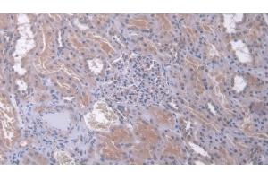 Detection of DUSP6 in Human Kidney Tissue using Polyclonal Antibody to Dual Specificity Phosphatase 6 (DUSP6) (DUSP6 antibody  (AA 1-300))