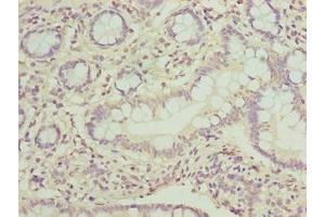 Immunohistochemistry of paraffin-embedded human small intestine tissue using ABIN7162860 at dilution of 1:100 (PPIL3 antibody  (AA 2-161))